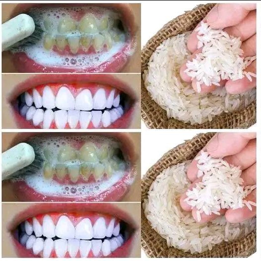 un tema sobre la forma de blanquear los dientes